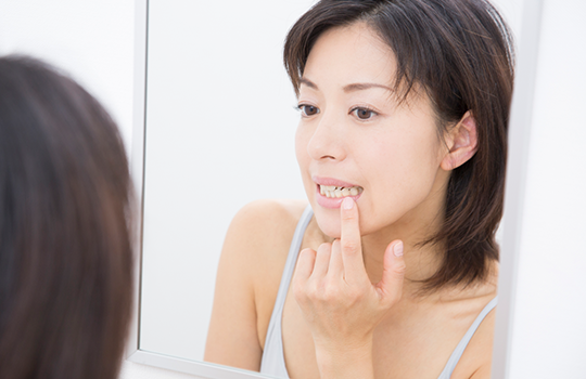 インプラント治療トラブルについて~インプラント周囲炎~