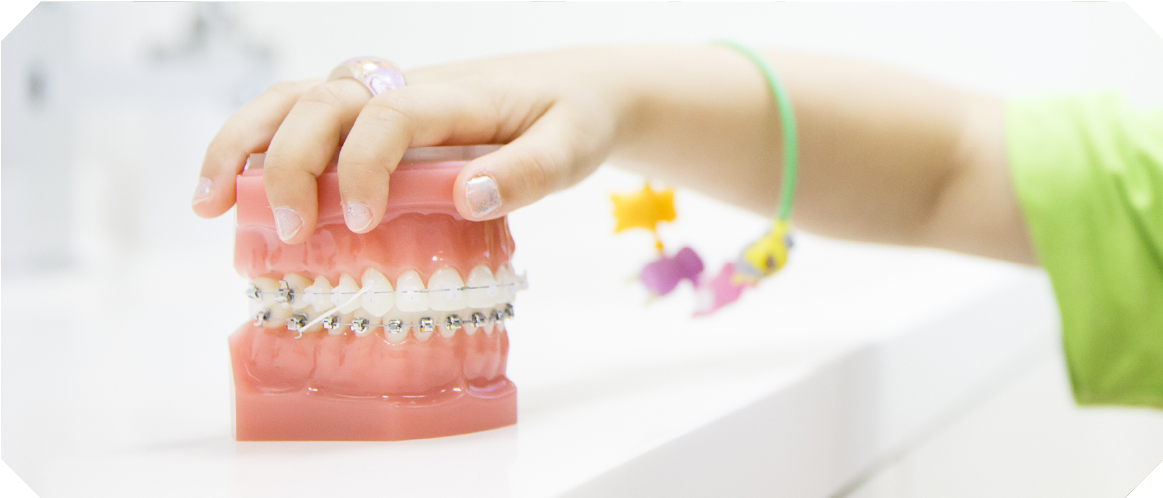 小児歯科で用いる矯正装置について