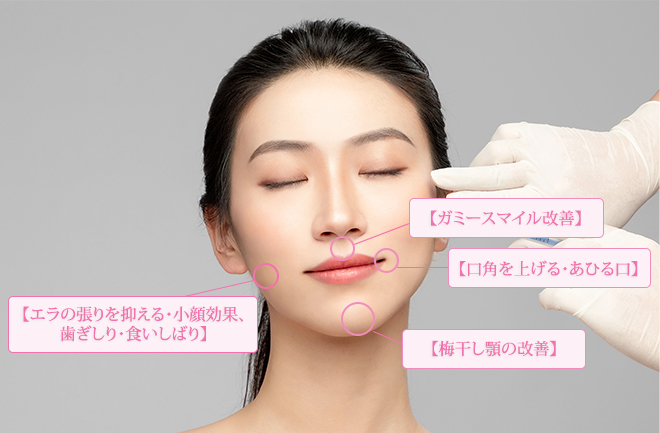 ボツリヌス治療とは？