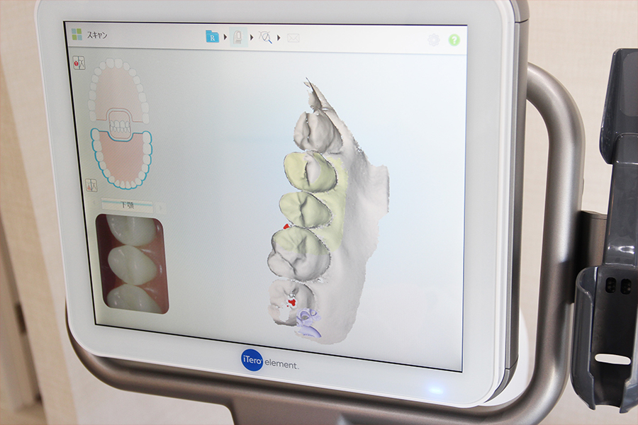 3Dスキャナー「iTero Element（アイテロ エレメント）」を使用します