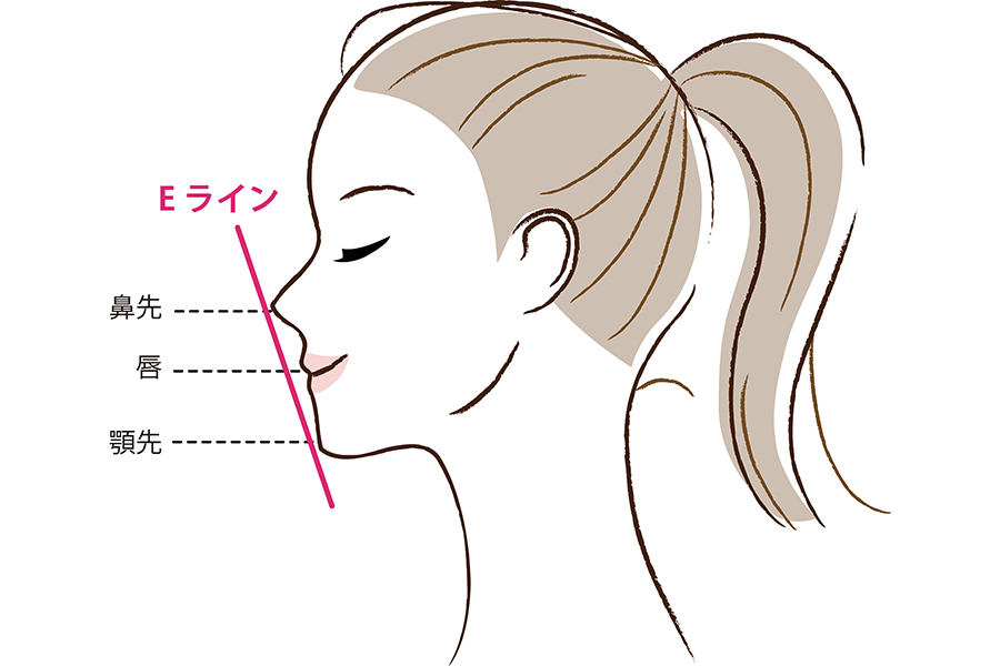 理想的なEラインに近づける矯正治療